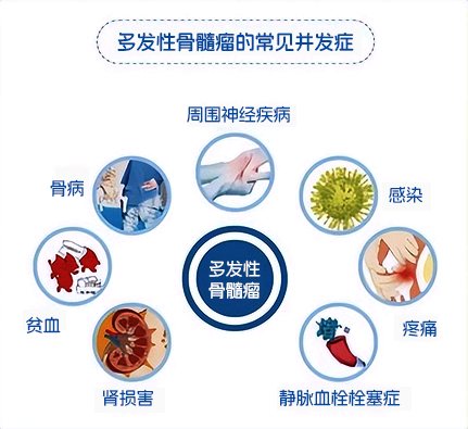 M蛋白上演消失的她？——淺談多發(fā)性骨髓瘤的診斷與療效評(píng)估