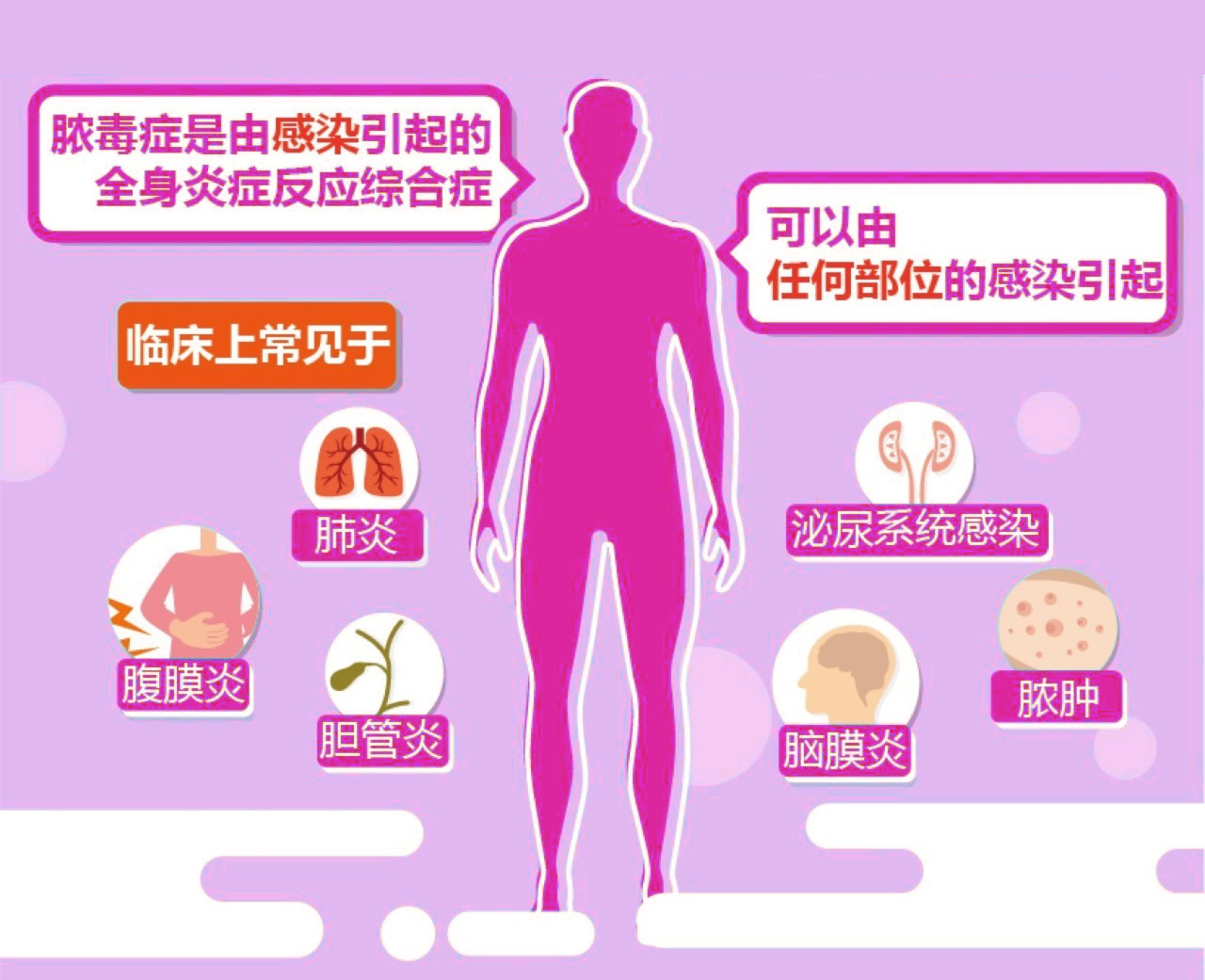世界膿毒癥日|國賽生物PCT-IL-6聯(lián)合檢測多種解決方案